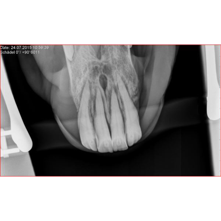 XtandR Equine xray biteplates for equine dental xrays Podoblock USA