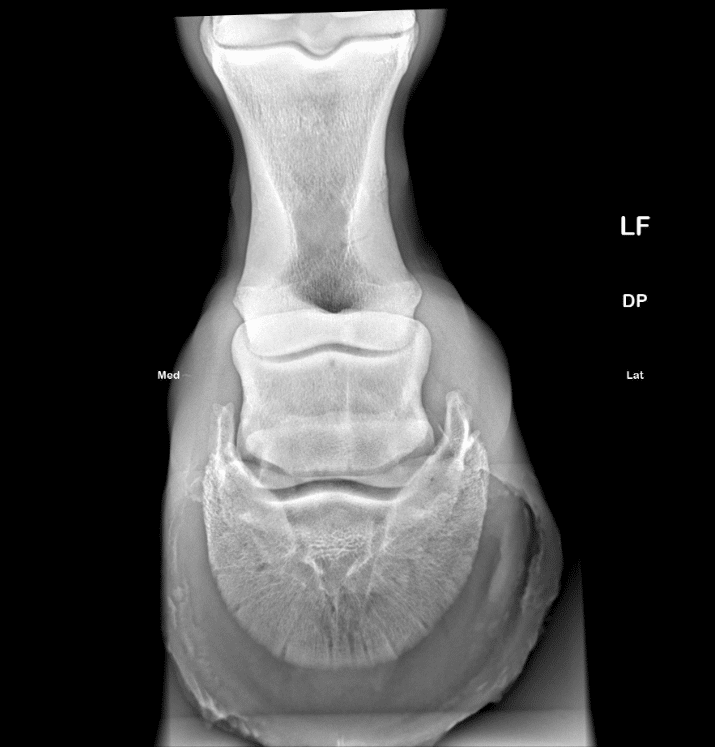 Podoblock <span>Configuration</span> - Image 11